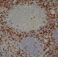 AM05530SU-T - CD8