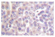 AP06422PU-N - PLA2G4B