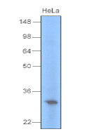 AM09040PU-N - Uracil-DNA glycosylase (UNG)