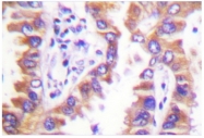 AP06425PU-N - Calnexin
