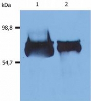 SM3000P - Albumin