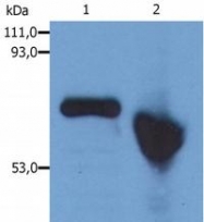 SM3089P - Alpha-fetoprotein / AFP