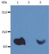BM604S - Beta-2-microglobulin