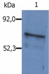 SP3004P - B-cell linker protein / BLNK