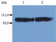 SM3103P - CD18 / ITGB2