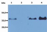 SM3014AS - CD20