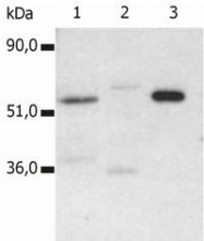 SM3019P - CD4