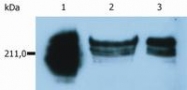 SM1115P - CD45 / LCA