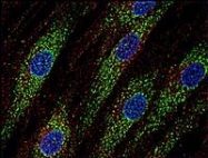 SM3035P - CD63
