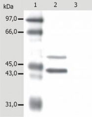 DM182P - Cytokeratin 5