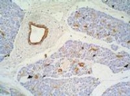 SM3046P - Cytokeratin 7