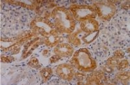 SM3043P - Cytokeratin 18