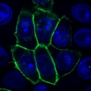 SM3132P - TNFRSF21 / Death receptor 6 (DR6)