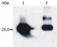 SM3155P - GST-Tag