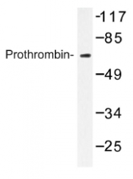 AP01171PU-N - Prothrombin (F2)