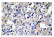 AP01171PU-N - Prothrombin (F2)