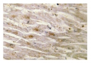 AP01174PU-N - CEBPG