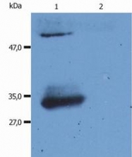 SM3062P - Human IgG