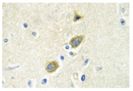 AP01178PU-N - GAS6 / AXLLG
