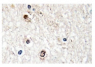 AP01179PU-N - NAB2