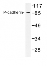 AP01184PU-N - Cadherin-3