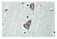 AP01184PU-N - Cadherin-3