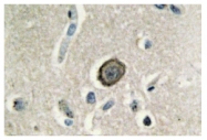 AP01185PU-N - Cadherin-8