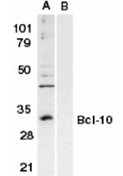 AP05829PU-N - Bcl-10