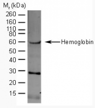 AP05441SU-N - Hemoglobin