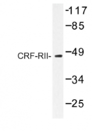 AP01195PU-N - CRHR2