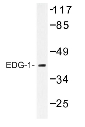 AP01197PU-N - EDG1 / S1P1