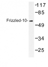 AP01204PU-N - CD350 / FZD10 / Frizzled-10