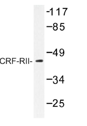 AP01213PU-N - CRHR2
