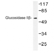 AP01229PU-N - Glucosidase 2 subunit beta