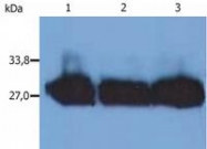 SM3064P - Human Kappa Light Chain