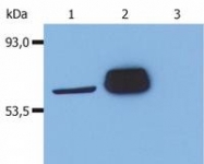 SM3066P - LCK