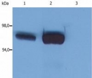 SM3135P - LCP2