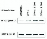 SM3125P - STAT1