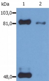 SM3126P - STAT1