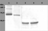 SM3127P - SYK