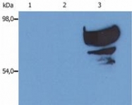 SM3156P - Transferrin