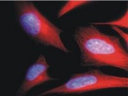 BM753S - alpha Tubulin / TUBA1B