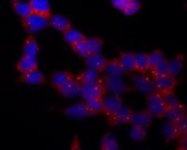 AM03014PU-N - TUBG1 / Tubulin gamma 1