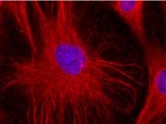 SM3128P - Vimentin