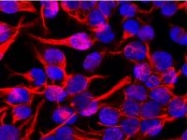 SM3128P - Vimentin