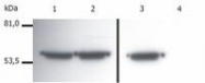 SM3128P - Vimentin