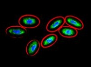 SM3166P - Vimentin