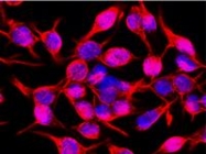 SM3166P - Vimentin