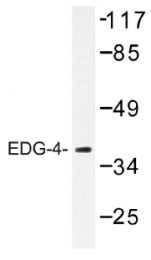 AP01254PU-N - EDG4 / LPAR2