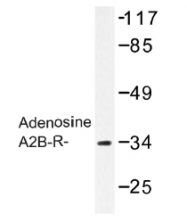 AP01260PU-N - Adenosine receptor A2b